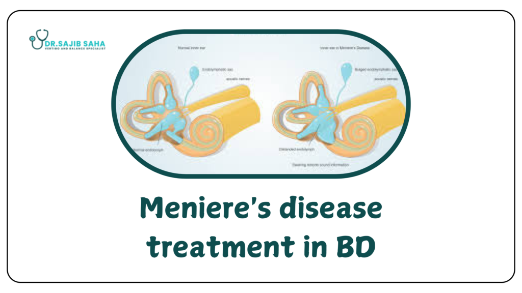 menieres disease treatment in bd